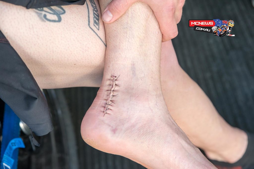 Sean Condon raced with a freshly operated on ankle at Wakefield Park