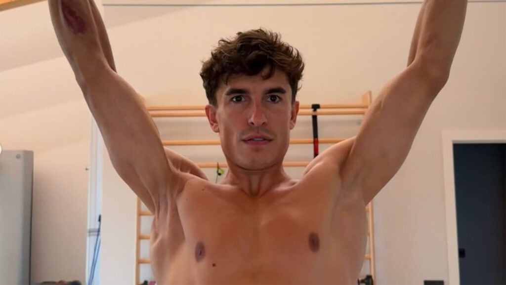 Front view of Marc Márquez training with both arms raised, with surgical scarring and reduced muscle bulk visible on his right arm.