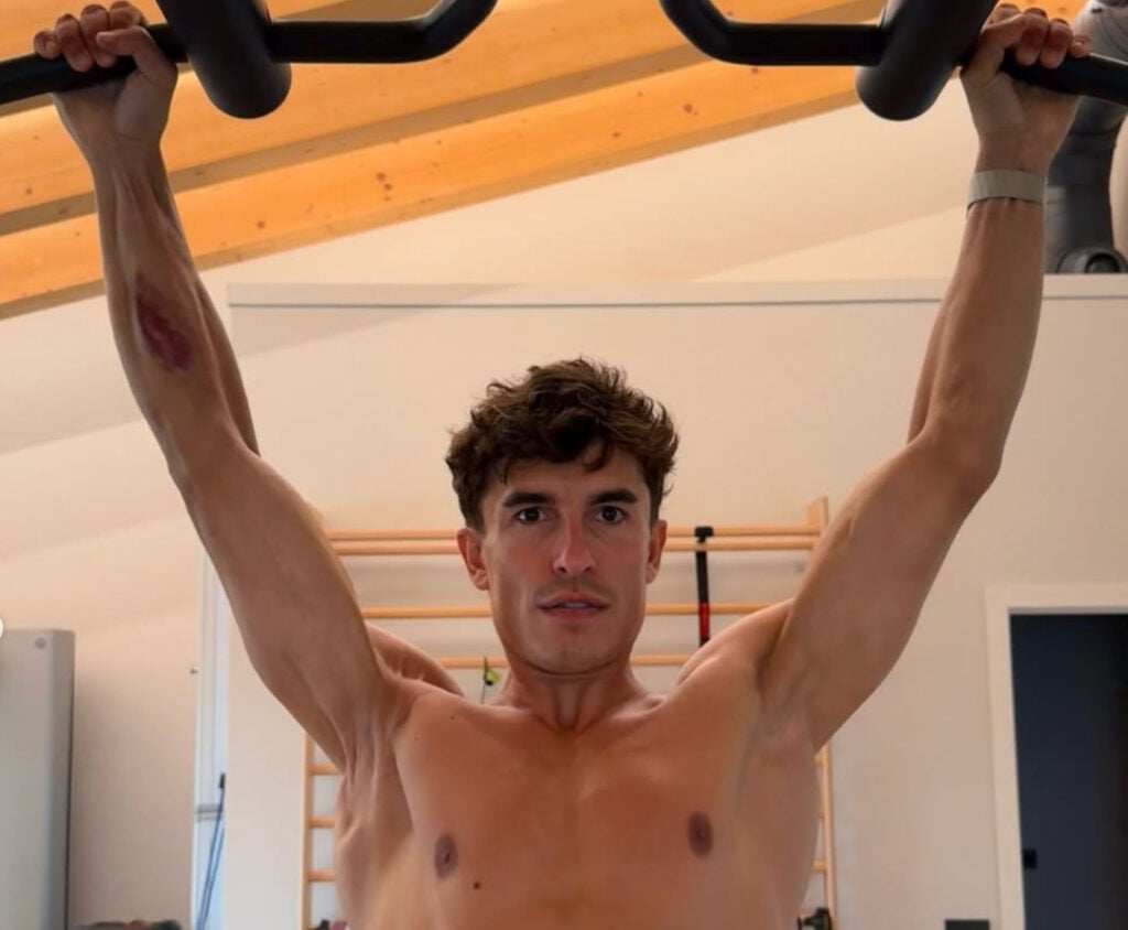 Marc Márquez holds an overhead exercise bar in a gym, showing visible muscle asymmetry and scarring on his right upper arm.